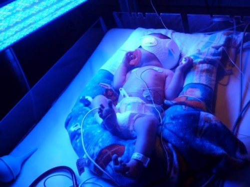 Little Aiden ICU