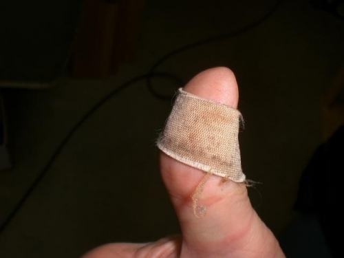 Ouch....I will save you from the gory pic