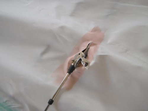 Releive around flap teleflex cable