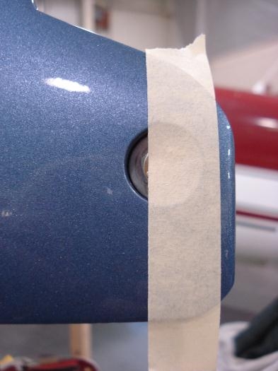 Right side before surgery.