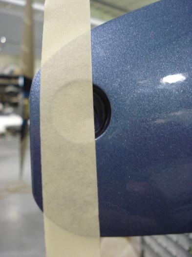 Left side before surgery.