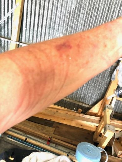 Casualty of building.  Many times before and I'm sure some more times in the future.