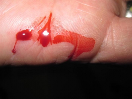 What happens when you get careless handling the wing skins.